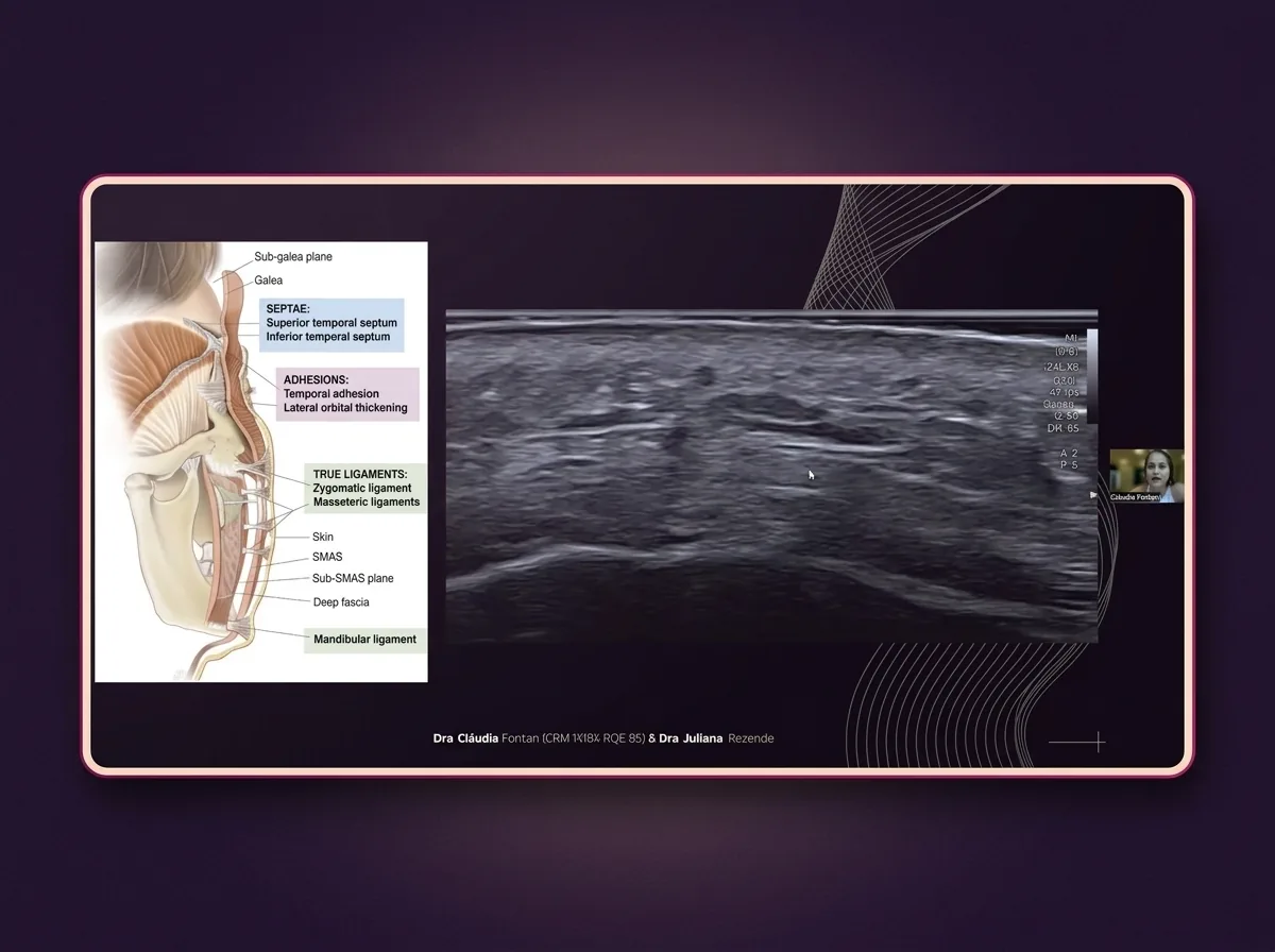 Slide do módulo 1 mostrando o esquema de camadas da face ao lado de uma imagem de ultrassom