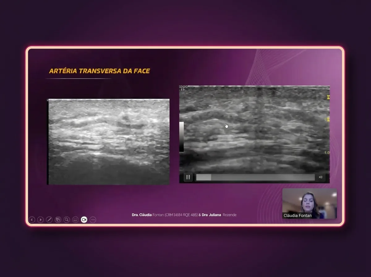 Slide do módulo 2 sobre a artéria transversa da face, com duas imagens de ultrassom comparadas