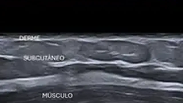 Quadro da aula de conceitos b&aacute;sicos em ultrassonografia musculoesquel&eacute;tica