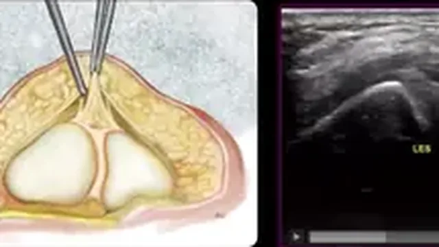 Quadro da aula de anatomia do punho normal